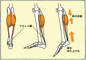 アキレス腱１